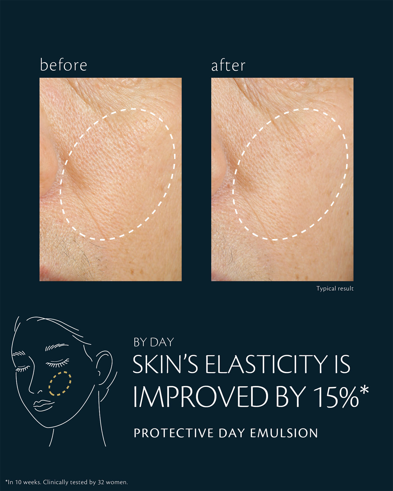 Photo of clinical test results for PROTECTIVE DAY EMULSION on 32 women, showing improved skin elasticity by 15% after 4 weeks and enhanced plumpness after ภายใน 10 สัปดาห์. The image compares the eye area before and after use, with the circled areas showing visibly smoother texture, reduced pores, and diminished fine lines.