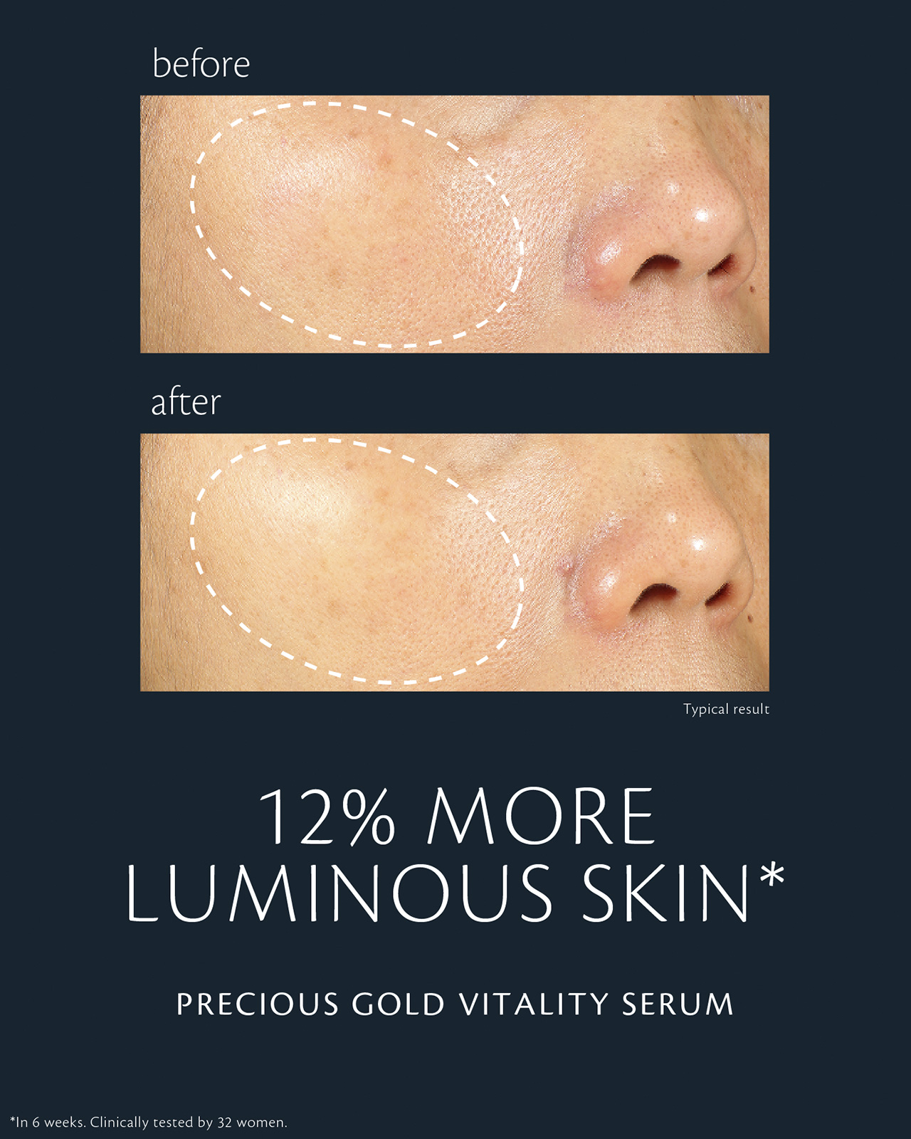 Photo of before-and-after comparison of skin using "PRECIOUS GOLD VITALITY SERUM." In the &ldquo;before&rdquo; image (top), skin appears less radiant; in the &ldquo;after&rdquo; image (bottom), radiance is improved by 12%. Clinical test conducted over ภายใน 6 สัปดาห์ with 32 women.