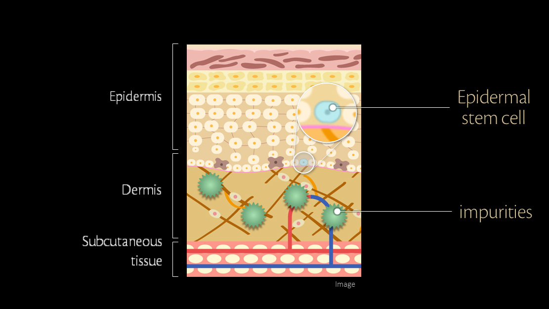 Illustration of a cross-sectional diagram of the skin layers (epidermis, dermis, subcutaneous tissue) showing the location of epidermal stem cells and impurities accumulated near the epidermis.